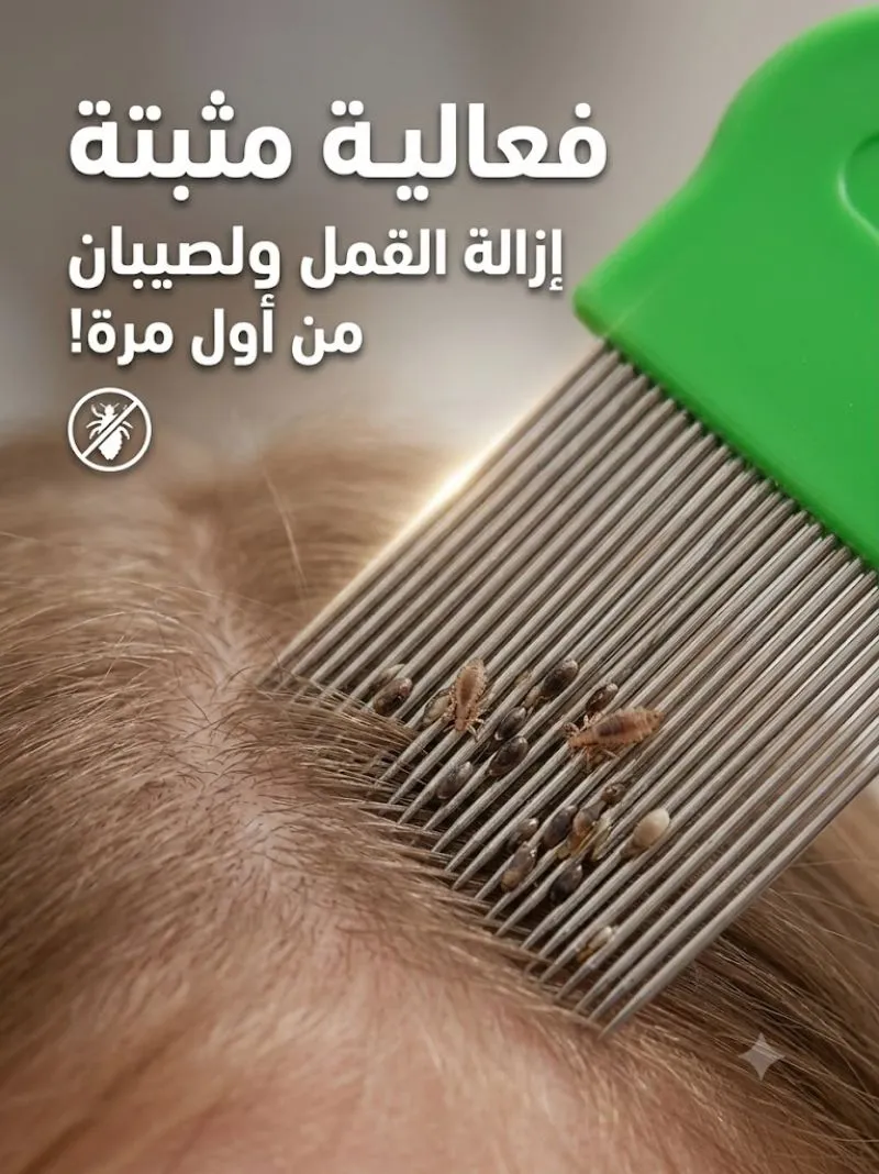 مشط مغناطيسي لإزالة القمل والقشرة